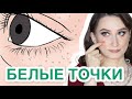 Милиумы - это болезнь❓ИЗБАВЛЯЕМСЯ НАВСЕГДА❗️