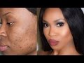 How to cover scars and dark spots - Highlight and Contour