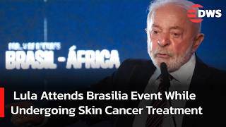 WATCH: President Lula Attends Official Brasilia Event After Starting Skin Cancer Treatment | AC15