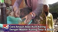 Cara Ampuh Merawat Kulit Kering Dengan Masker Kuning Telur & Madu "Tips Cantik Alami Merawat Wajah" - Durasi: 2.03. 