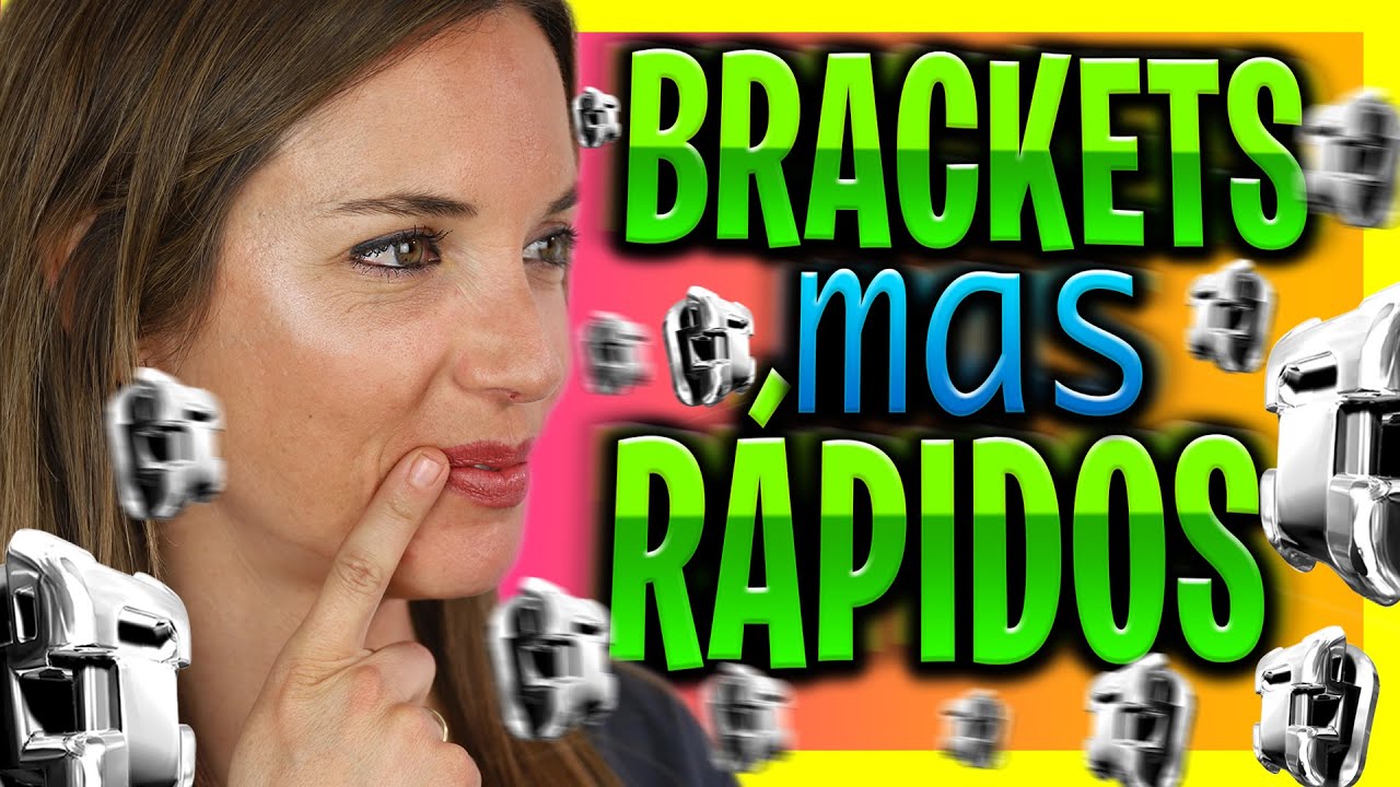🏃♂️como ACELERAR el tratamiento de ORTODONCIA.👉CEPILLARSE los dientes con BRACKETS CORRECTAMENTE ortodoncia mexicali