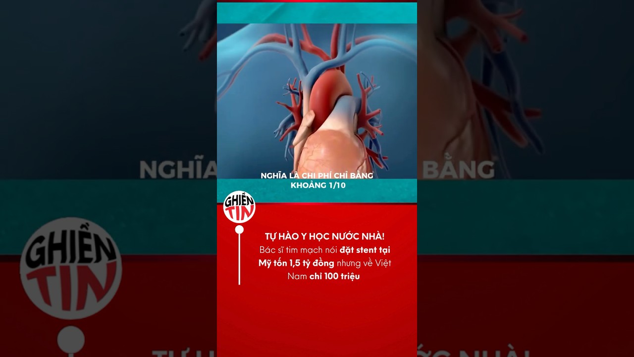BÃ¡c sÄ© tim máº¡ch Má»¹ bá»‹ báº¥t ngá»: Äáº·t stent táº¡i Má»¹ tá»‘n 1,5 tá»· Ä‘á»“ng, vá» Viá»‡t Nam chá»‰ 100 triá»‡u #health
