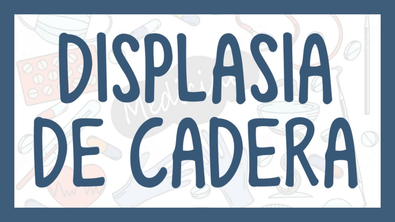 LUXACIÓN CONGÉNITA DE CADERA | ¿Cómo diagnosticar la displasia de cadera?