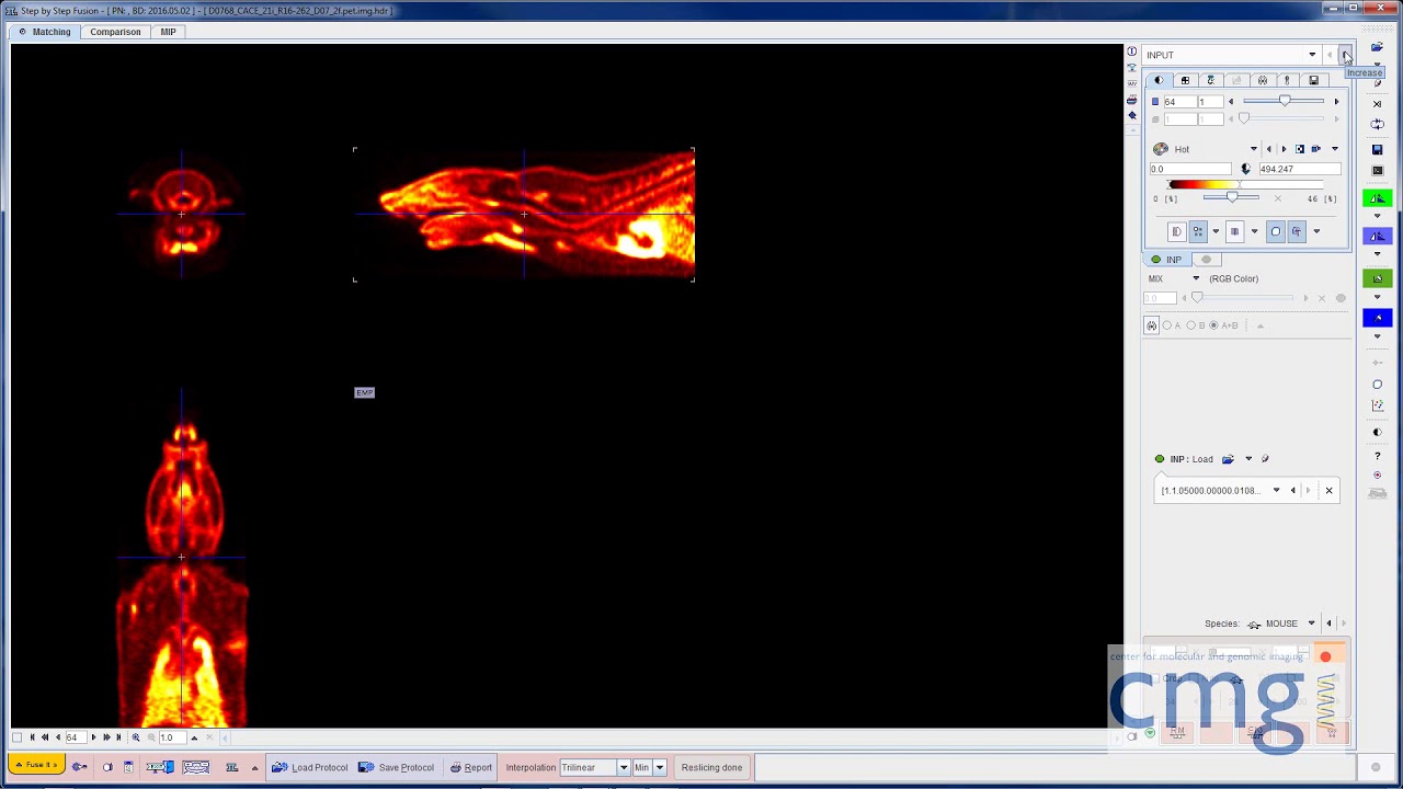 PMOD PET Registration and Reference Tissue Modeling Analysis - YouTube
