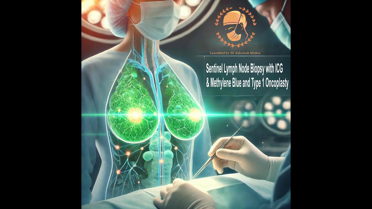 Live workshop - Sentinel Lymph Node Biopsy with ICG & Methylene Blue ...