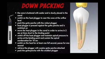 warm vertical compaction endodontic continuous wave obturation fast fill fast pack eighteeth