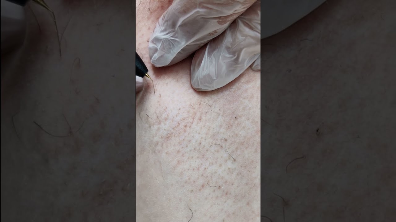 Электроэпиляция в студиях депиляции Wax Bar.