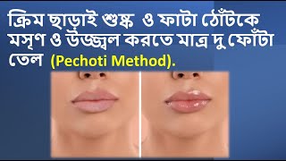 ফাটা ঠোঁট সারিয়ে তুলতে নাভিতে দিন মাত্র দু ফোটা তেল-Pechoti Method.