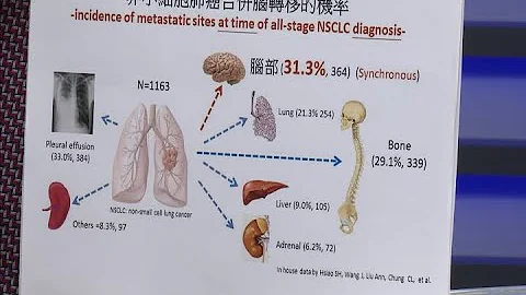 【名医妙方】认识肺癌晚期的治疗与「脑转移」2022.08.01 - 天天要闻