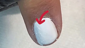 ¿Por qué se me levantan las uñas de gel?