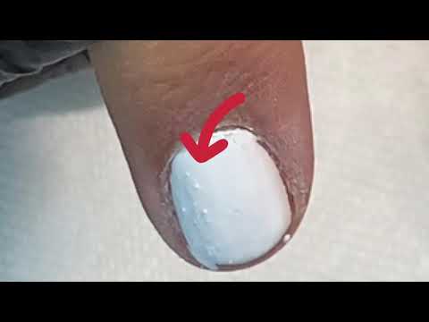 Video: Por Qué No Puedes Usar Esmalte En Gel Durante Mucho Tiempo