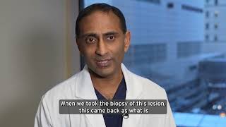 Complex Case: Diagnosing and Treating Pancreatic Neuroendocrine Tumors
