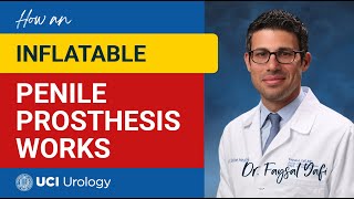 How an Inflatable Penile Prosthesis Works by Dr. Faysal A. Yafi - UCI Department of Urology