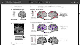 DBS for TRD: Analyzing the PACE Study, Bayes Tuning & Neural Network Mapping