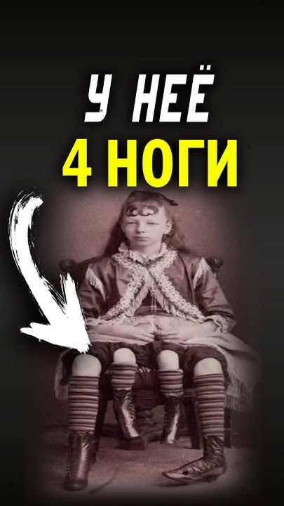 У неё 4 ноги! #интересныефакты #рекомендации #интересныелюди #теории # ...