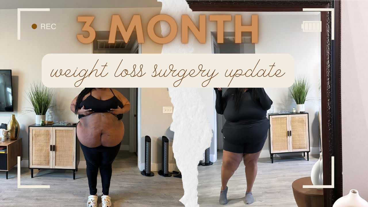 3 Month Weight Loss Surgery Update: Non Scale Victories, Loose Skin ...