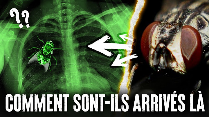 5 ANIMAUX retrouvés dans le CORPS HUMAIN ! #2