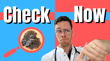 Jak rychle roste melanom?