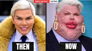 21 Celebrity Plastic Surgery Stories That Surprised Everyone | Then and Now Photos 2026