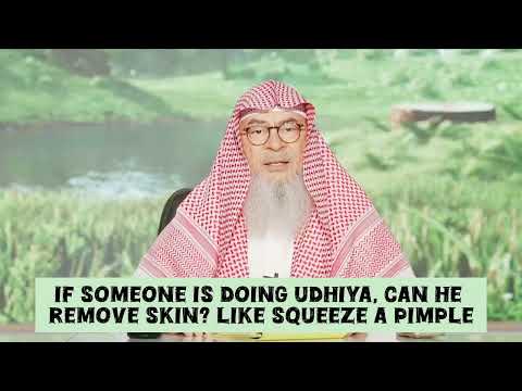 Was Prophet ﷺ given the choice to die? assim al hakeem