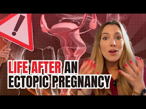 Everything you never knew about having an ectopic pregnancy!