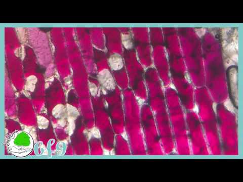 Video: Wie stark sind diese Zwiebelzellen vergrößert?
