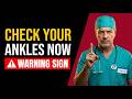 Swollen Ankles After 60? The Real Cause Most Doctors Don’t Explain
