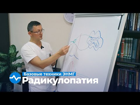 Диагностика радикулопатии. Базовые техники ЭНМГ. Курс Юрия Пономаренко