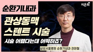 관상동맥 스텐트 시술: 시술이 어렵다는데 어떡하지요? / 삼성서울병원 순환기내과 권현철