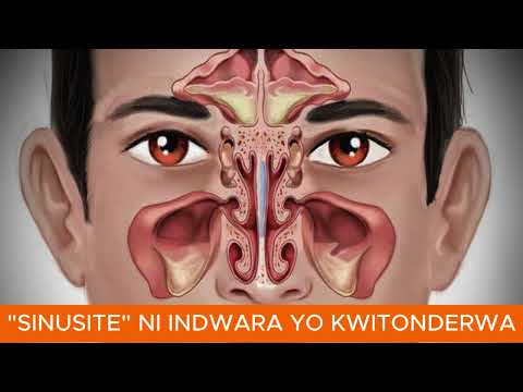 UKO WAHANGANA AN'INDWARA YA "SINUSITE" IKUNZE KWIBASIRA BENSHI