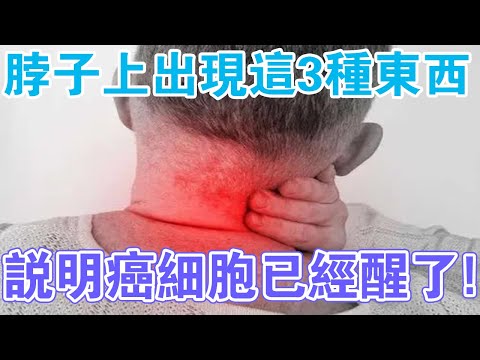 注意！脖子上出現這3種東西，說明你體內癌細胞已經醒了！及時做好3件事