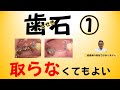 歯石は取らなくても良い
