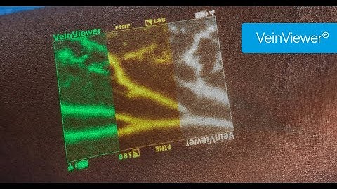 Video VeinViewer Patient video