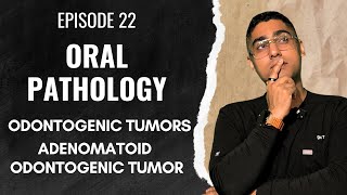 Dental Digest Oral Pathology Episode 22 - Aot