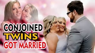 CONJOINED TWINS JUST GOT MARRIED | Who Gets S**X... Find Out