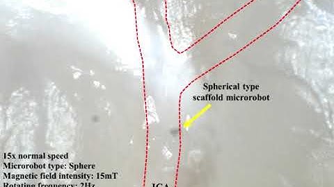 Magnetic microrobots line up for stem cell therapy