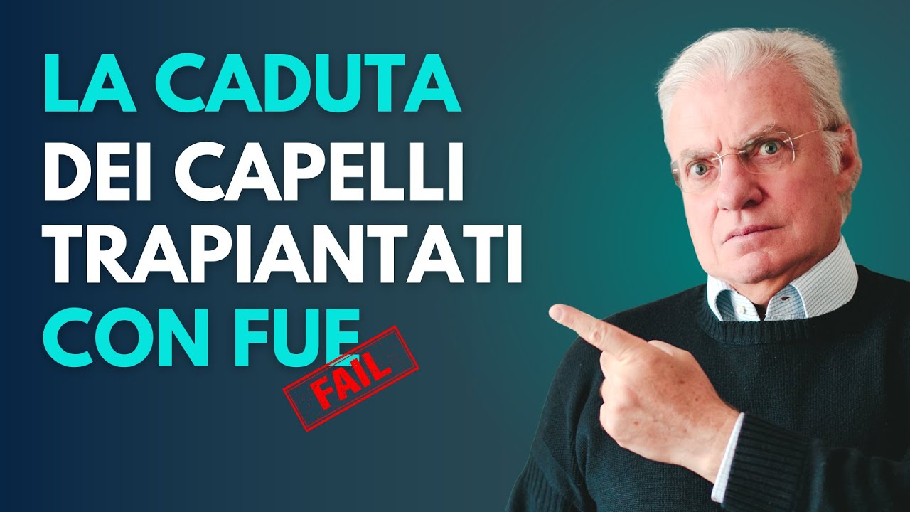 La caduta dei capelli trapiantati con la tecnica FUE