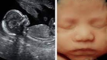 Watch the adorable 4D Ultrasound video of a baby girl