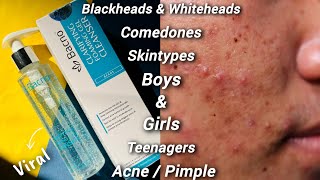 Facewash For Acne And Pimple Bacno Cleanser Best Acne Face Wash Ance Treatment Face Wash Best
