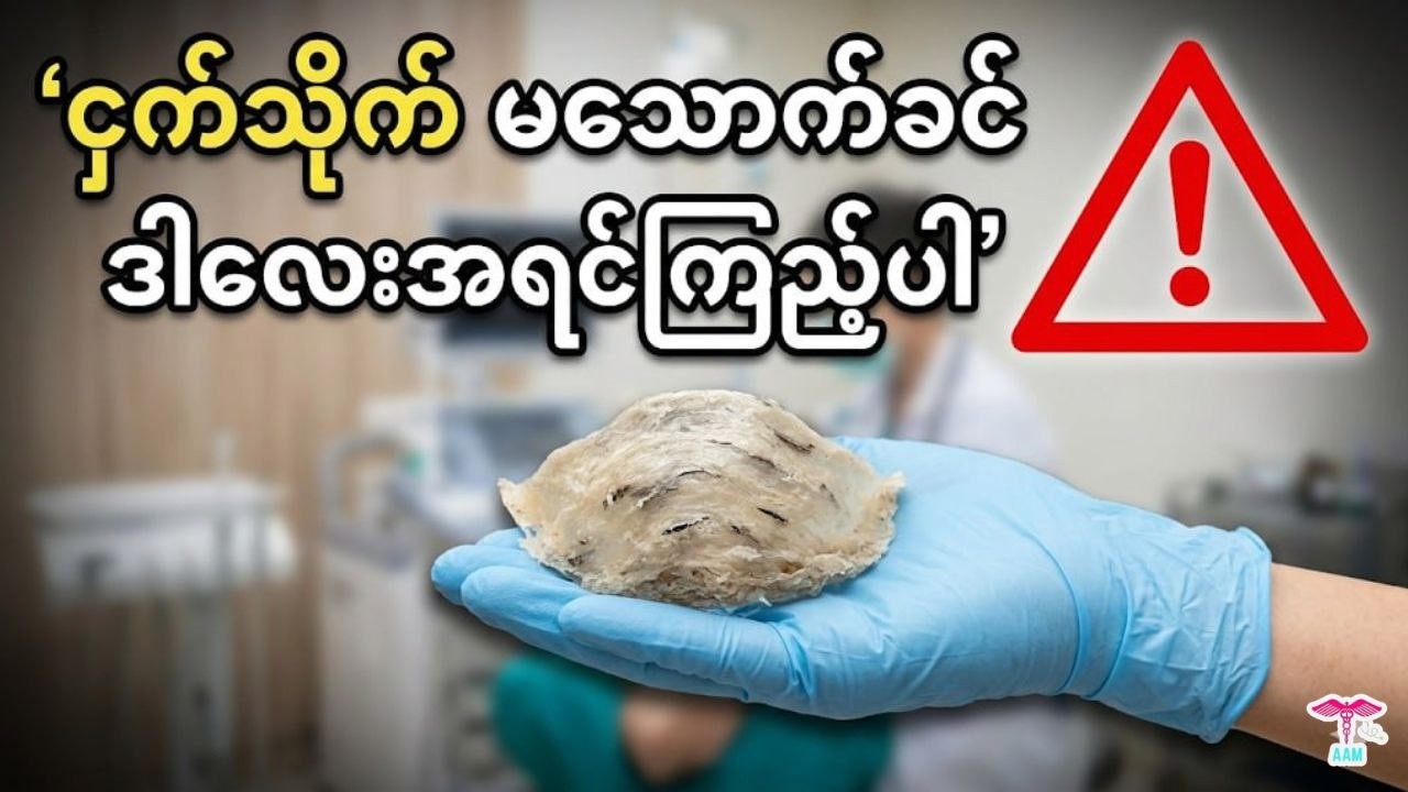 ငှက်သိုက်သောက်တာ တကယ်ပဲ အားရှိသလား? လူကြီးတွေ မဖြစ်မနေ သောက်ရမှာလား?