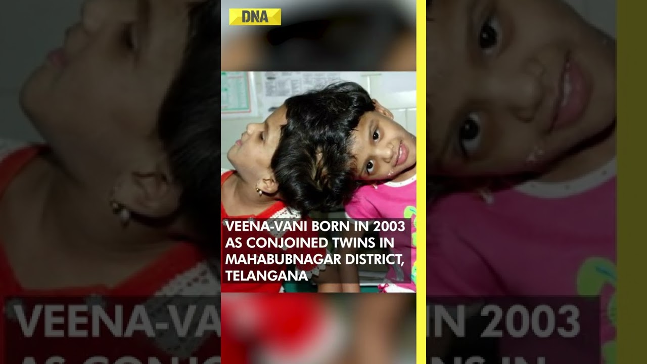 Conjoined Twins Veena-Vani Clear XII Boards Exams 