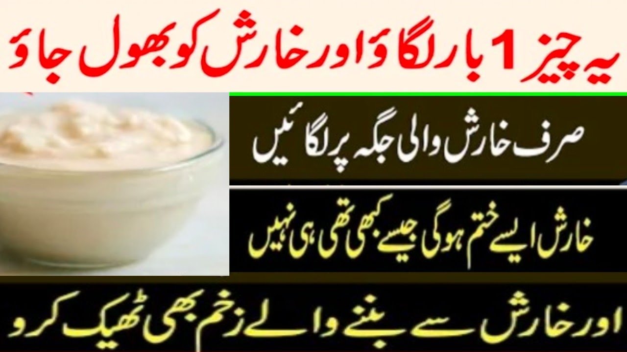 kharish or Khujli ka ilaj Body itching Home Remedy in Hindi/Urdu