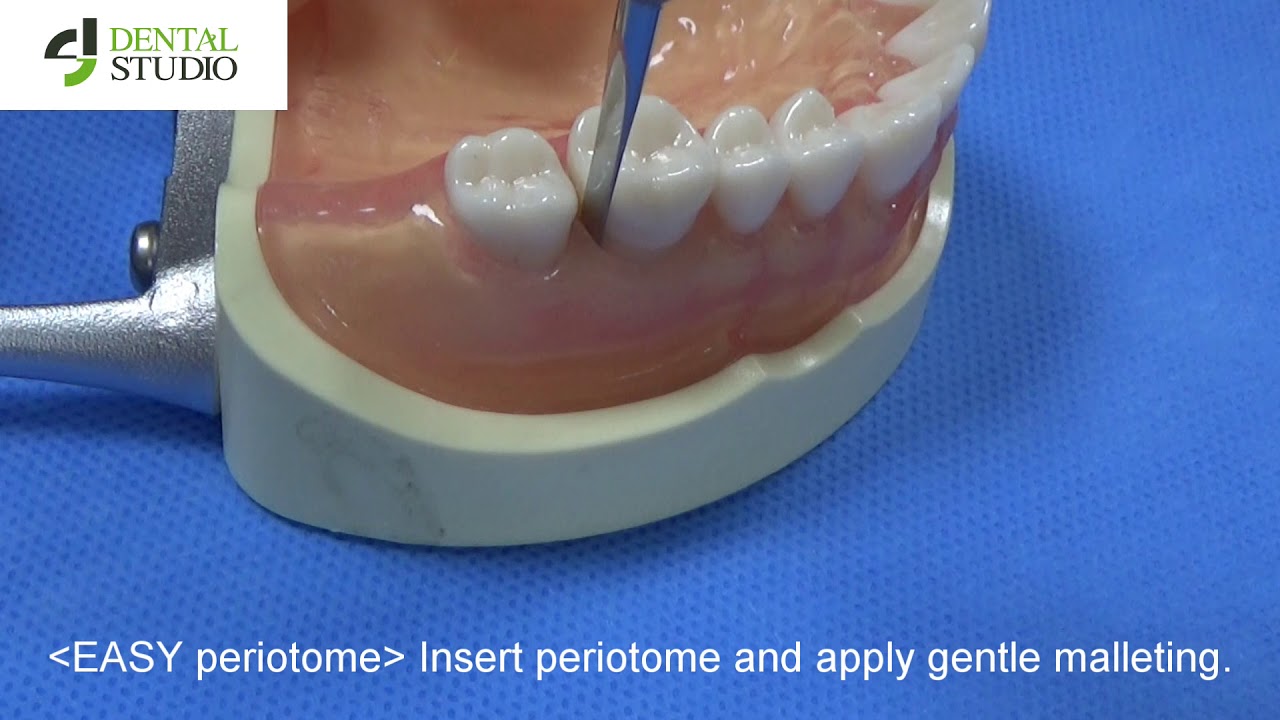 easy extraction model 0 YouTube