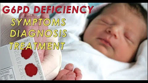 g6pdd Symptoms | Diagnosis | Treatment