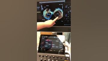 3D Zoom & Dual Volume Layout