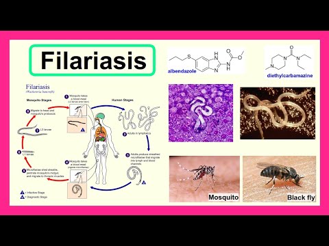 Video: Môžu filárie spôsobiť neplodnosť?