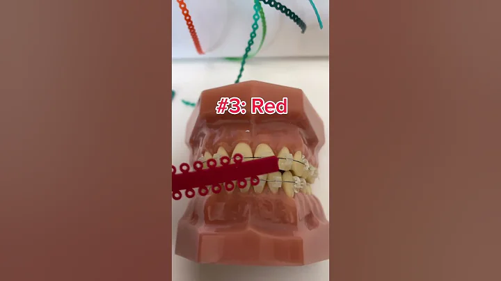 Braces colors that'll make you teeth look...👀🦷✨