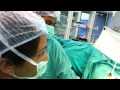 Very simple techniques of uterine balloon therapy