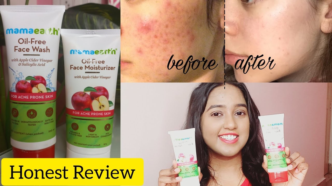 Face Wash & Moisturizer For Acne Prone Skin Mamaearth OilFree