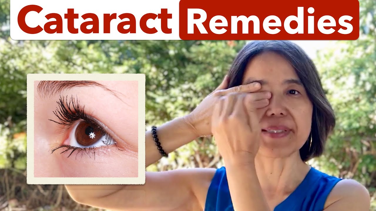 How to Prevent and Reverse Cataracts with Energy Healing YouTube